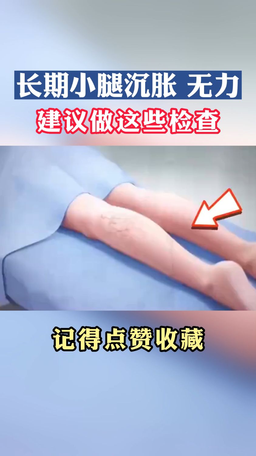 长期小腿发沉发胀,无力,建议做些检查