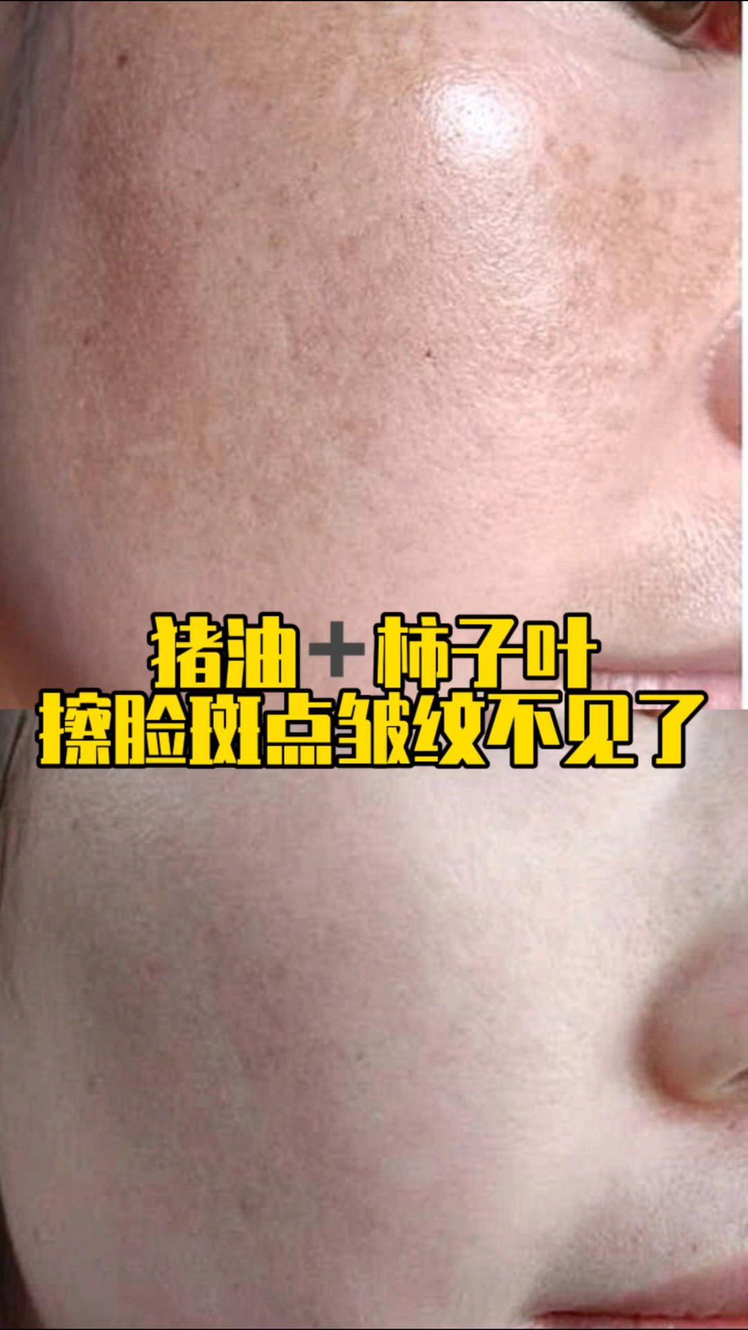 用猪油+柿子叶擦脸,斑点皱纹通通不见