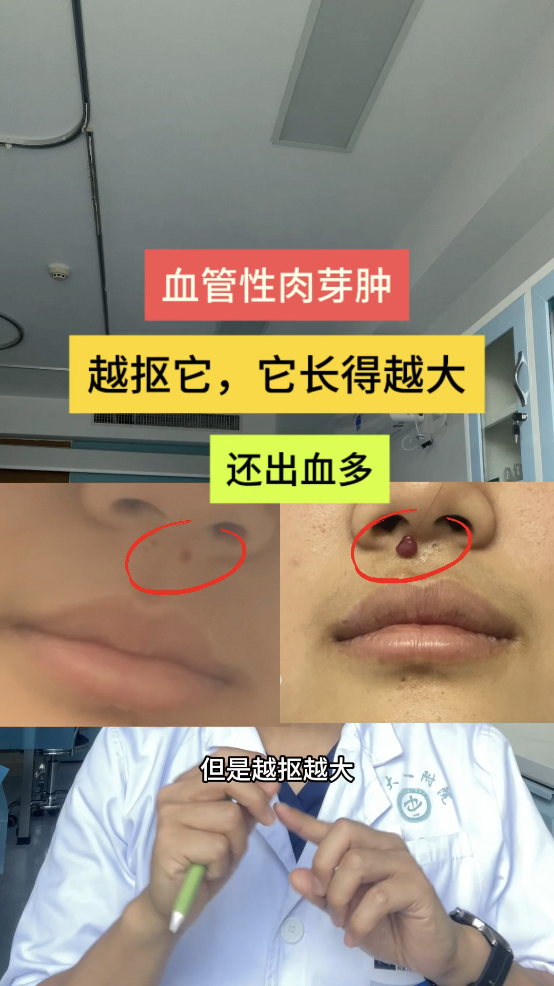 身上小红点,越抠越大,它可能是肉芽肿!