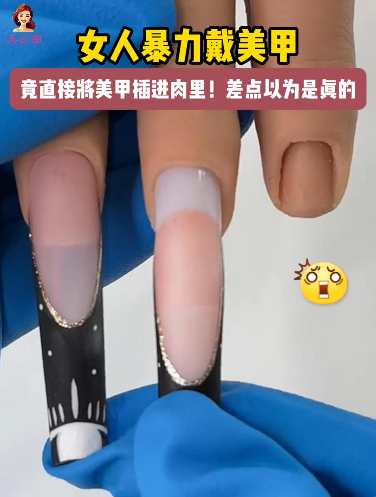 女人戴美甲,竟将美甲插进肉里两厘米深,这怕是容嬷嬷转世吧!