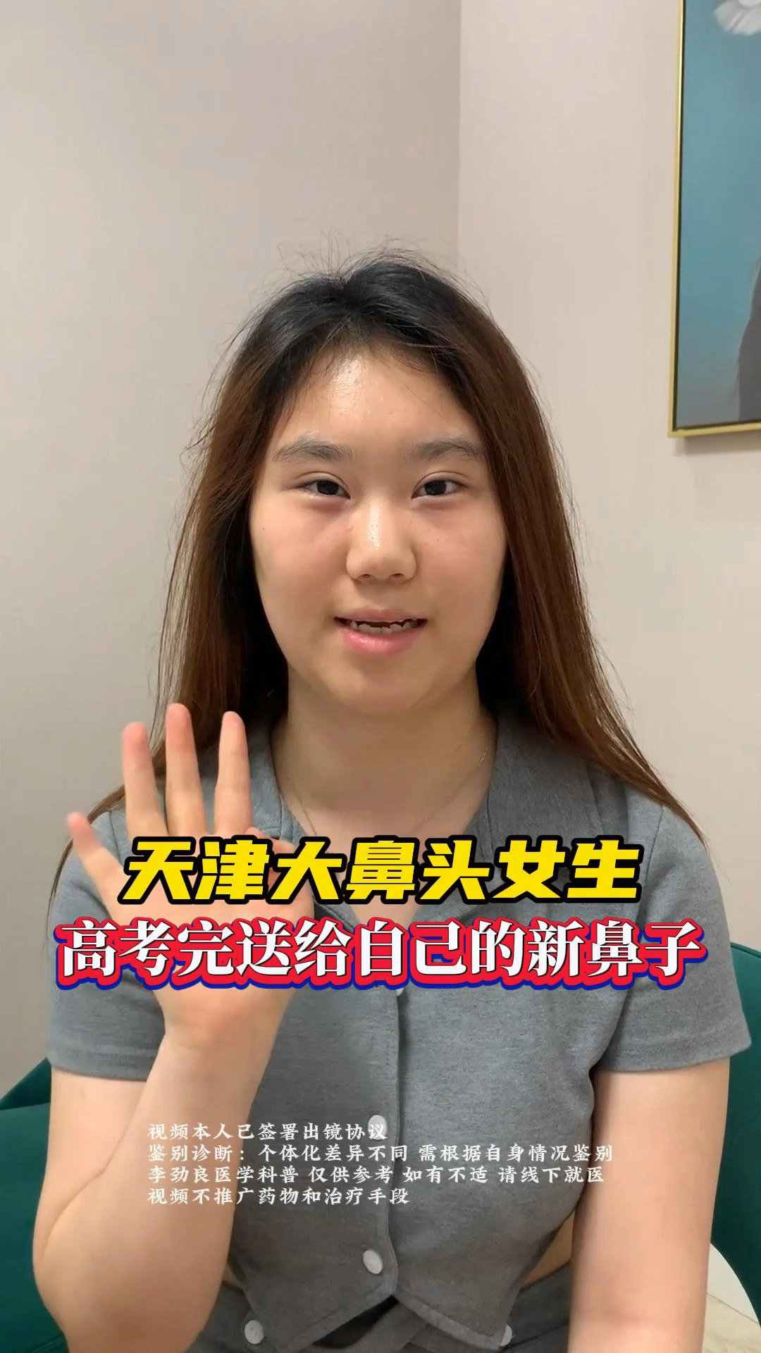 天津18岁大肉鼻头女孩,高考完送给自己的新鼻子,怎么样了?