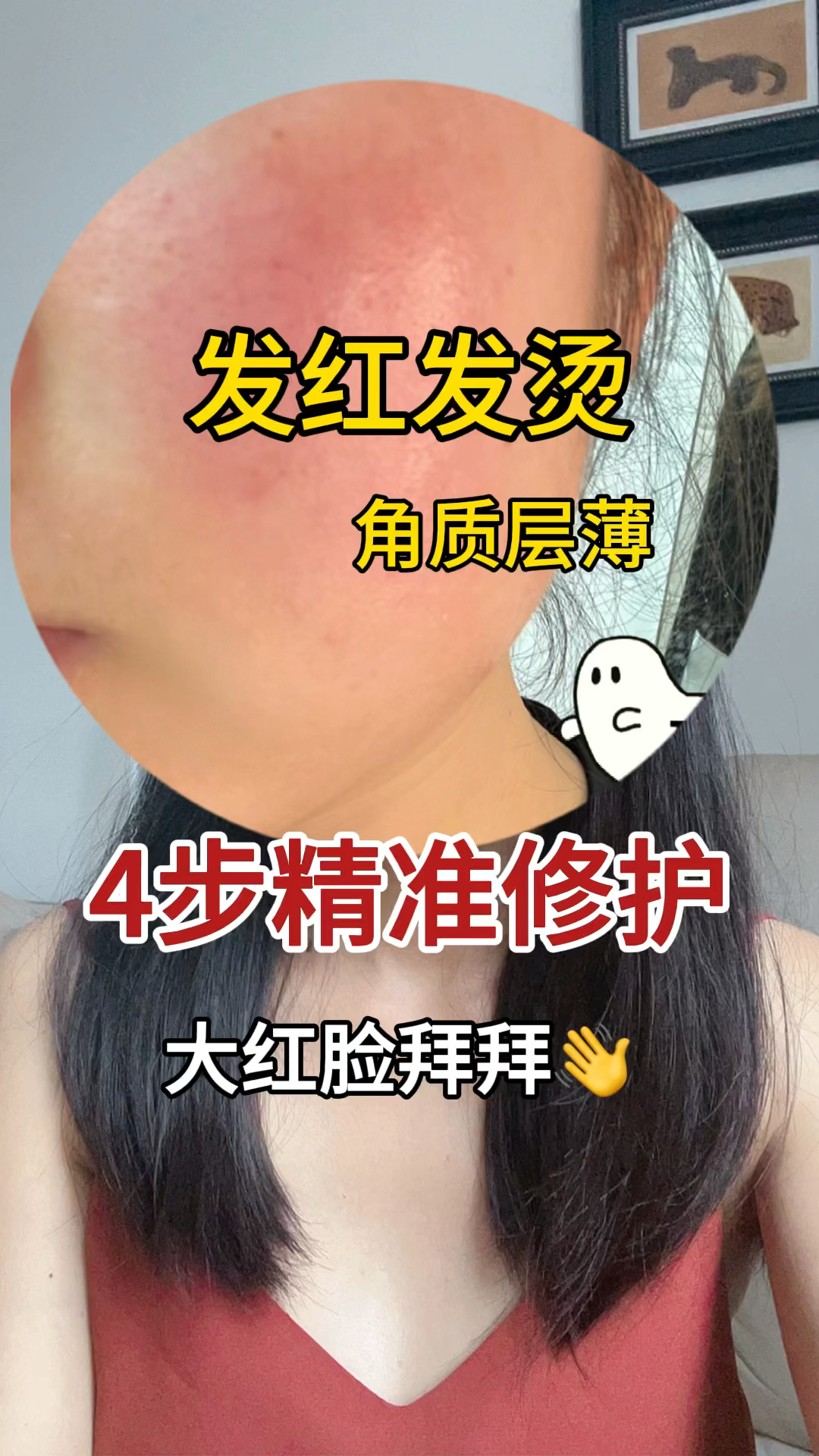 发红发烫角质层薄4步修护红烫脸