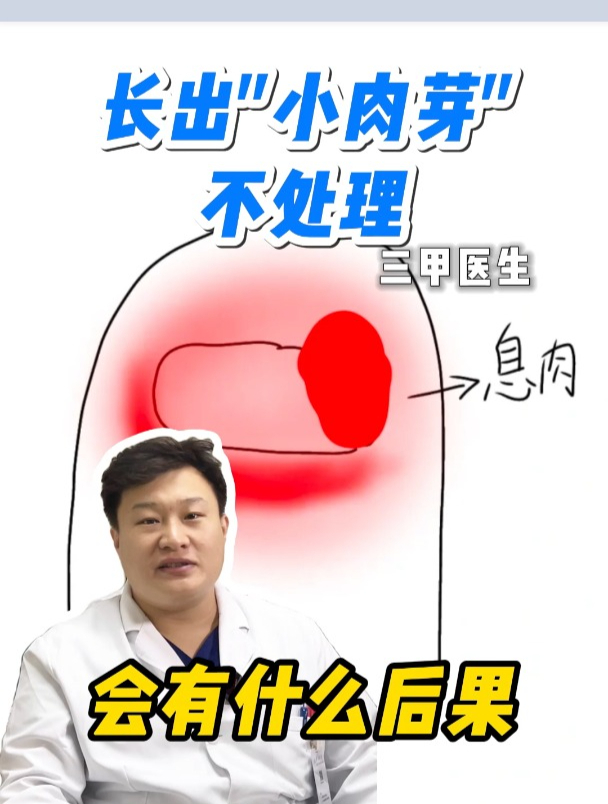 长出小肉芽不处理会有什么后果