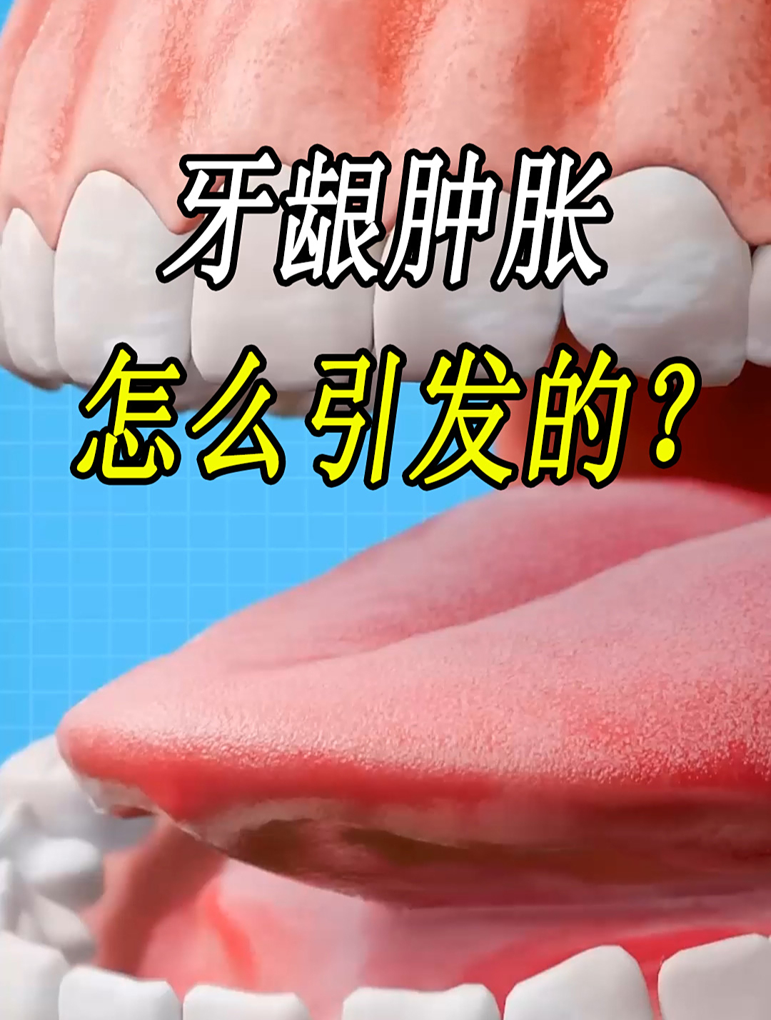 如果牙龈开始肿胀,并且会出现疼痛,这究竟怎么回事呢?