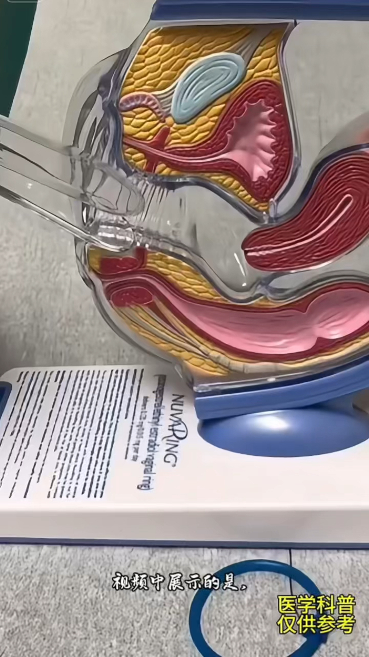 视频中展示医生如何用鸭嘴钳子检查患者身体 模拟训练