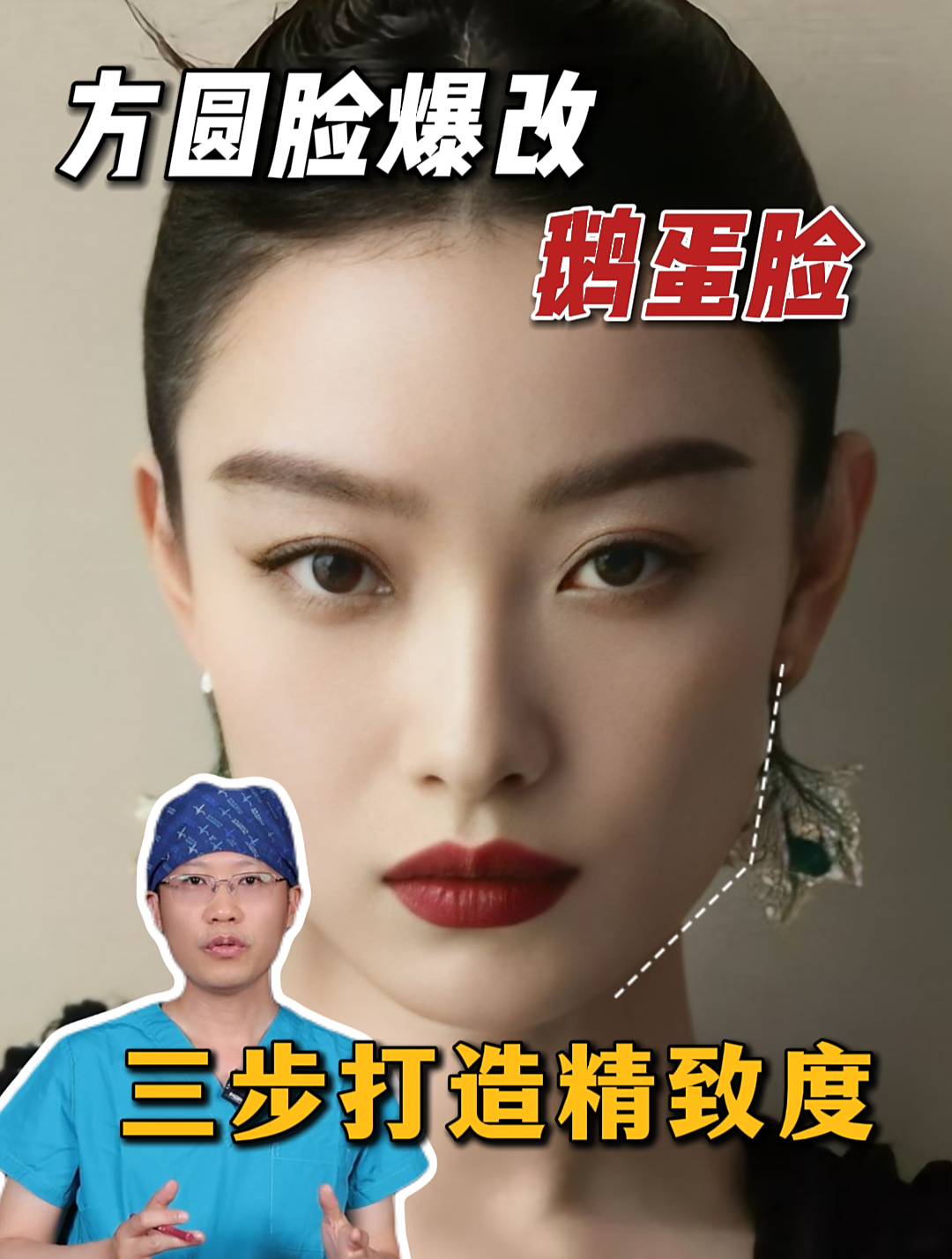 方圆脸爆改鹅蛋脸,主要调整哪几个方面?