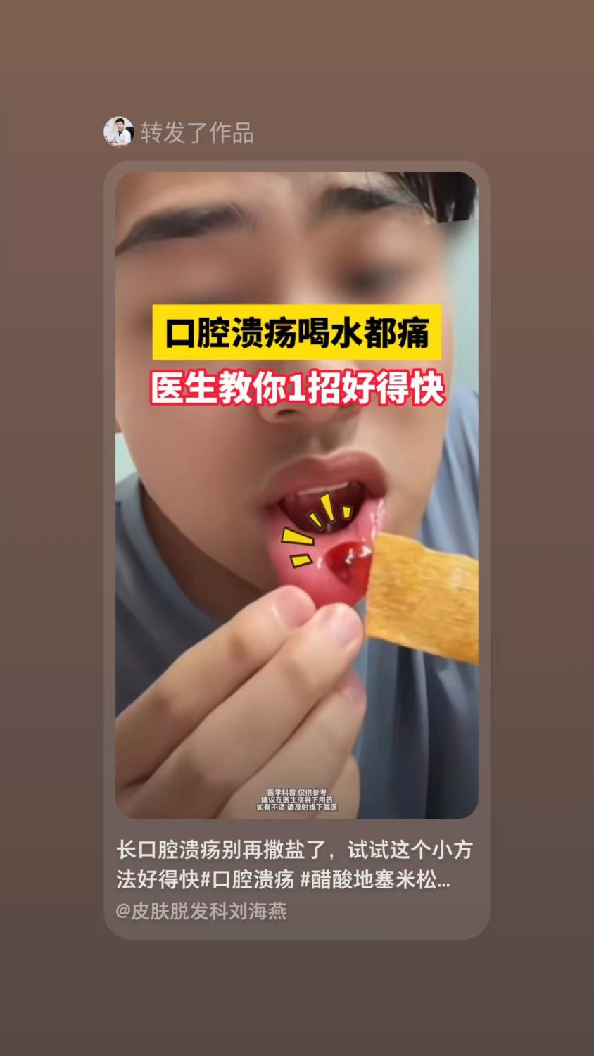 口腔溃疡这样好得快!
