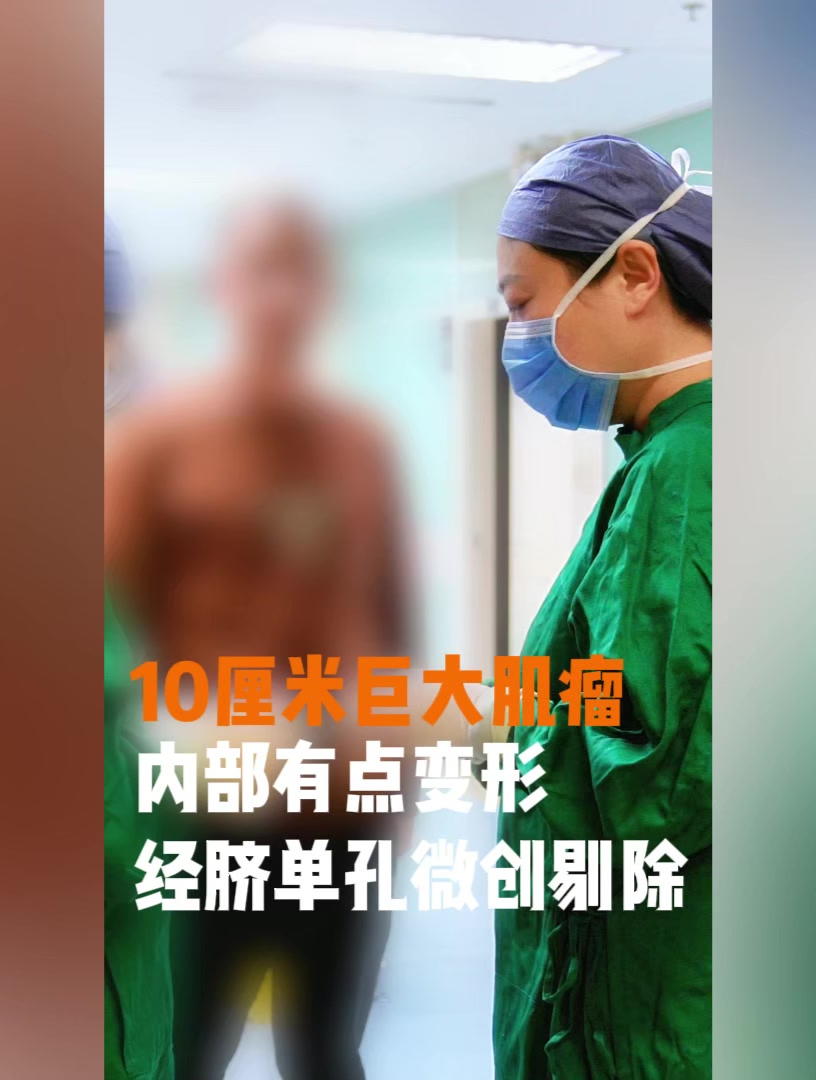 10厘米巨大肌瘤,内部有点变性,经脐单孔微创剔除!