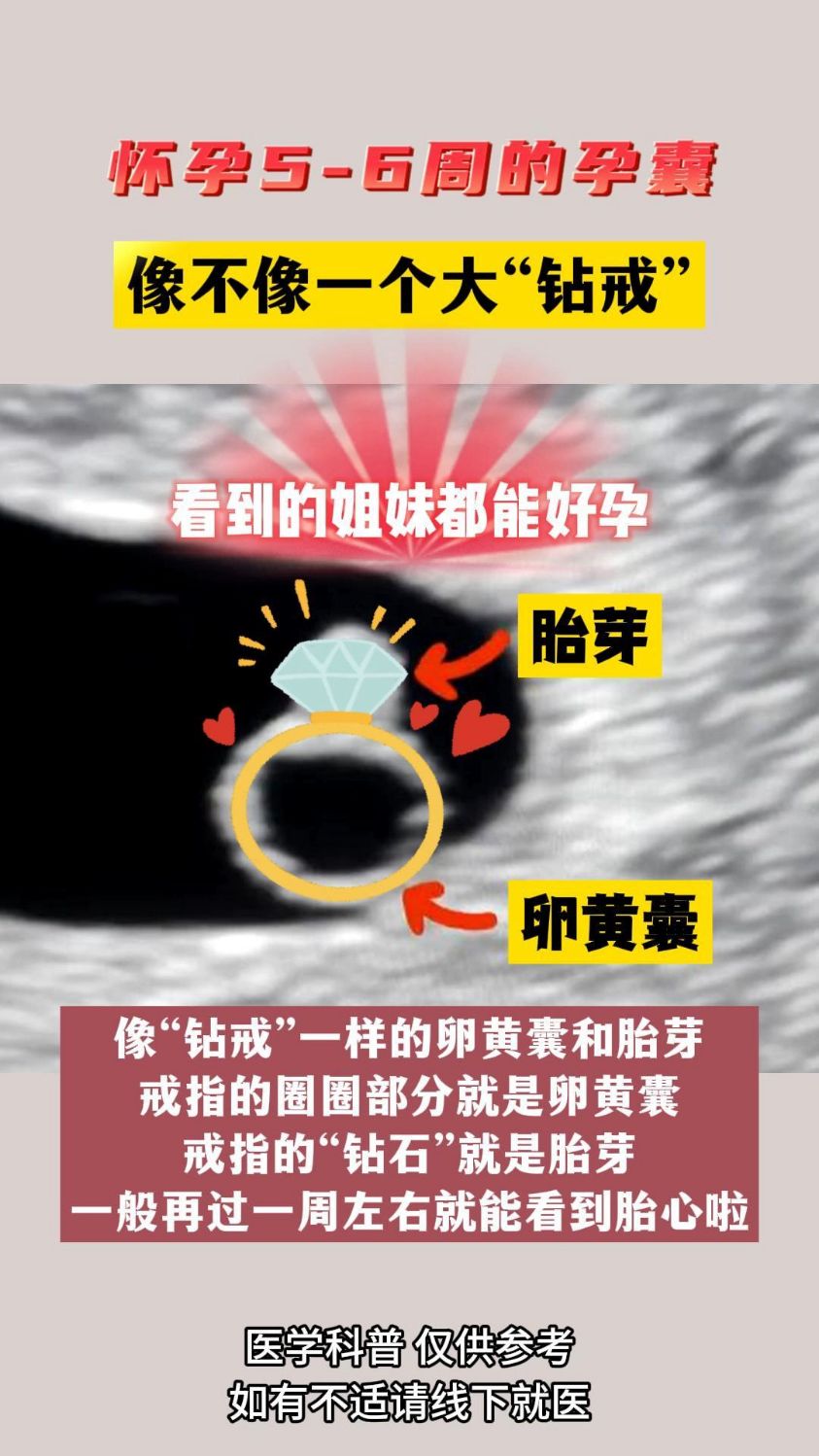 怀孕5-6周的孕囊,像不像一个大钻戒