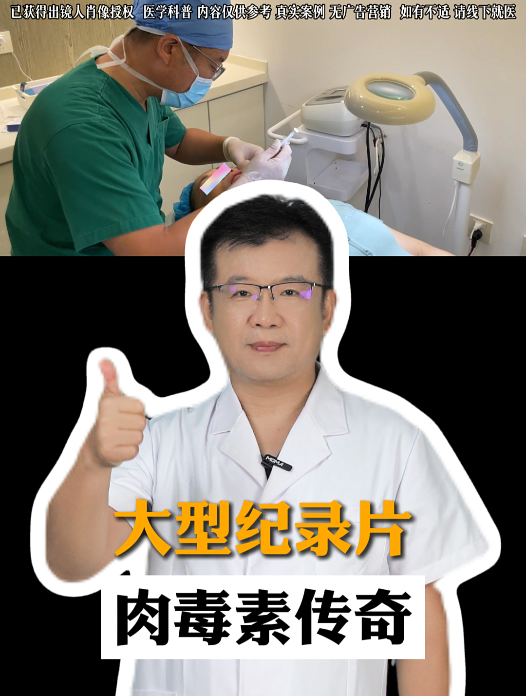 肉毒素都有哪些作用,最后一个,你绝对想不到!