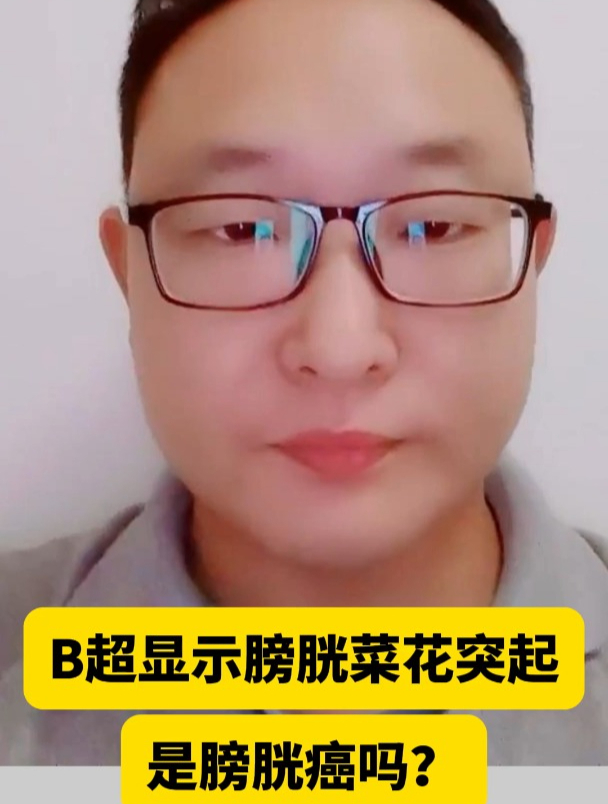 B超显示膀胱菜花突起是膀胱癌吗?