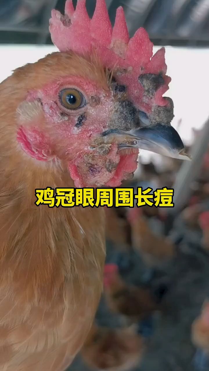 鸡冠眼周围长很多痘痘