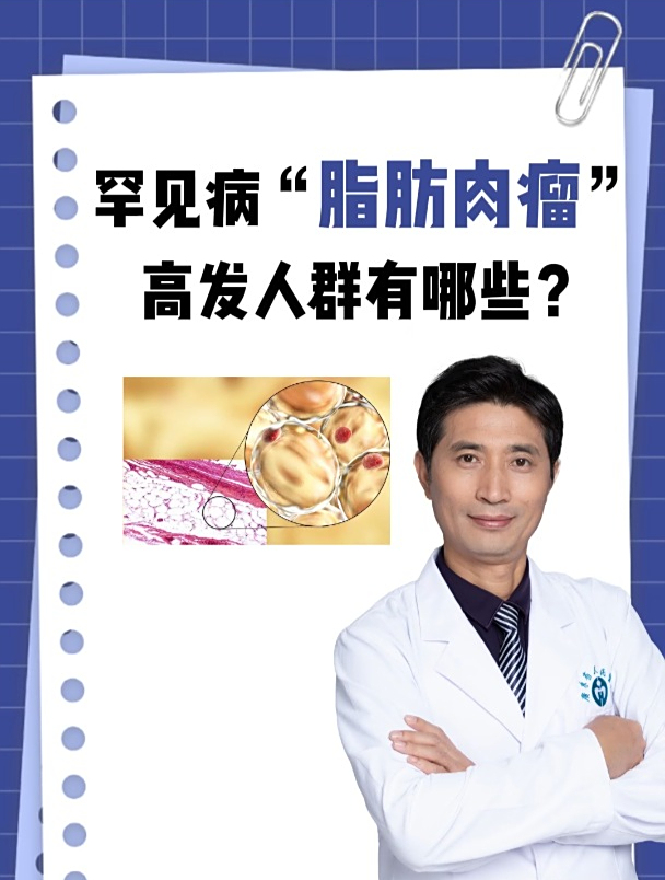罕见病“脂肪肉瘤”,高发人群有哪些?