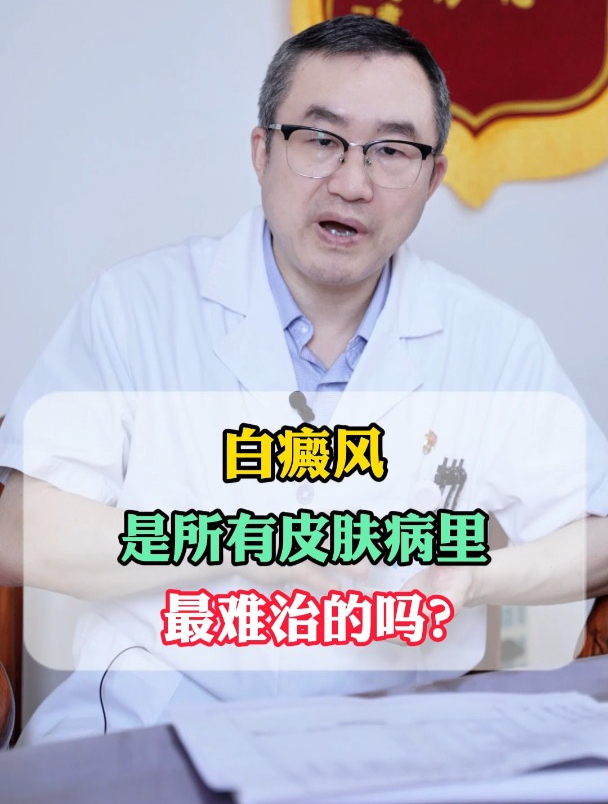 白癜风,是所有皮肤病里,最难治的吗?