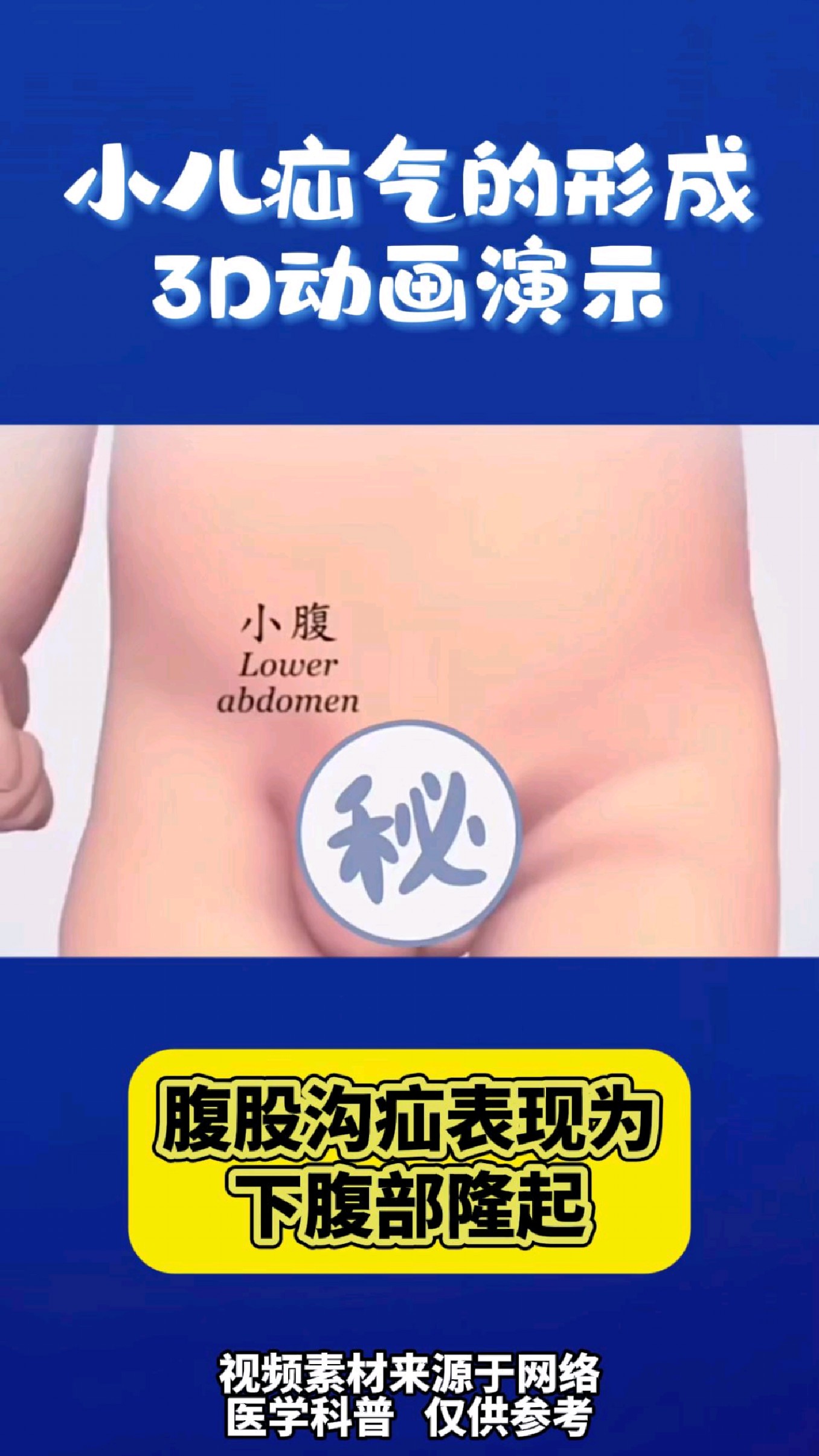 小儿疝气的形成!!!