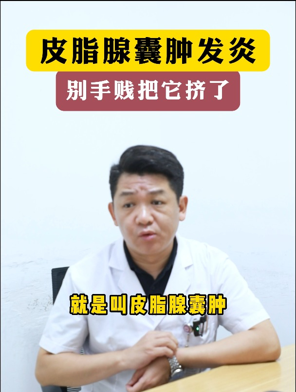 皮脂腺囊肿发炎,别手贱把它挤了