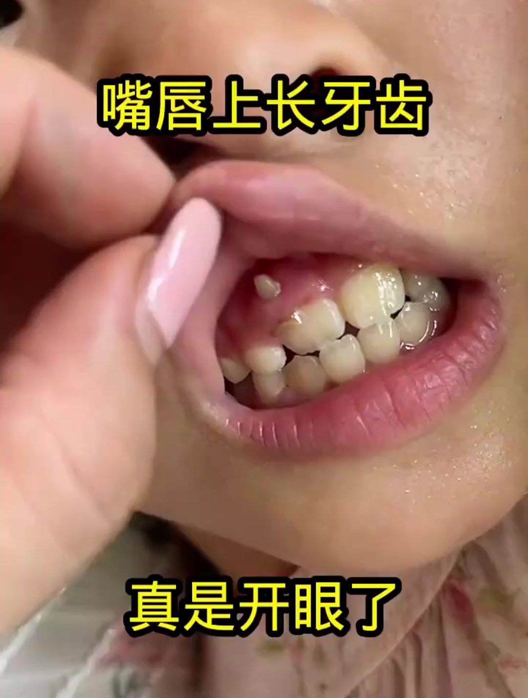 嘴唇上长牙齿,真是开眼了!