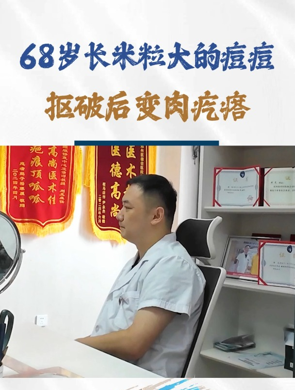 68岁患者长米粒大的痘痘,抠破后变肉疙瘩!