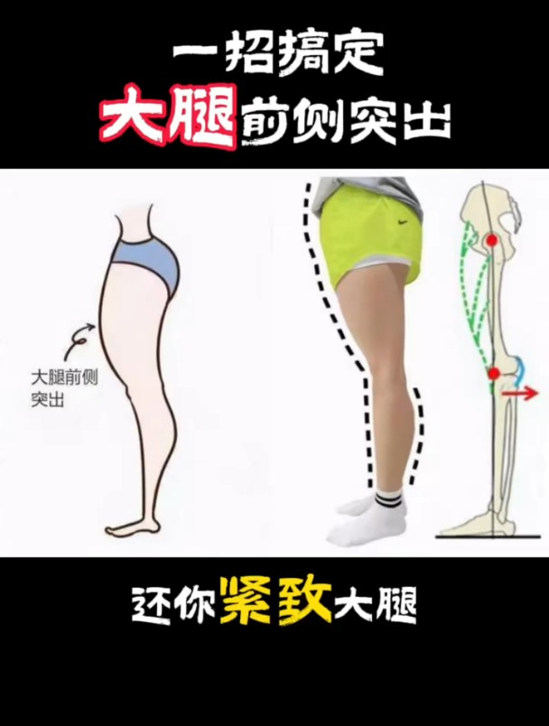大腿前侧特别发达突出,1招教你搞定