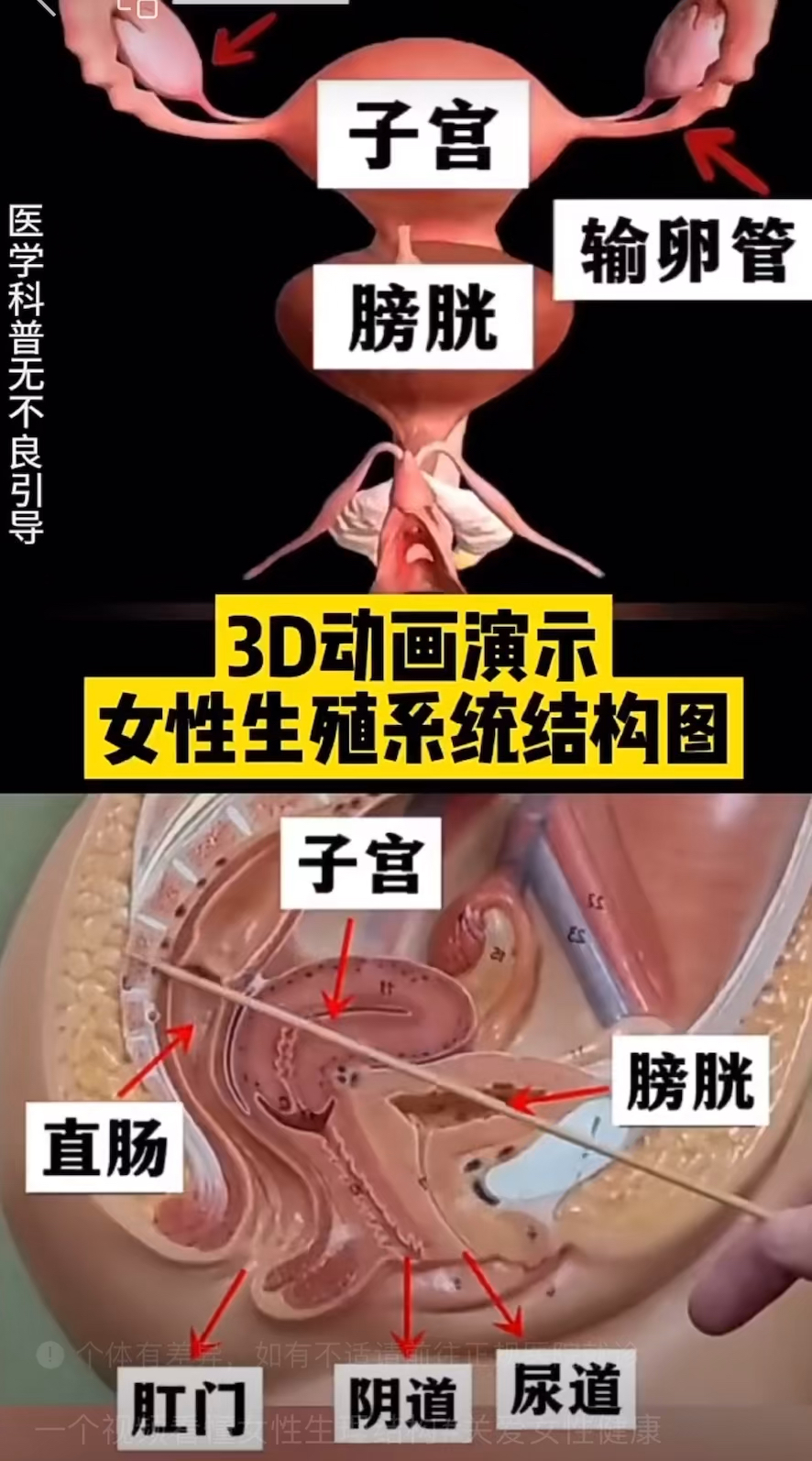 女性生殖系统解剖