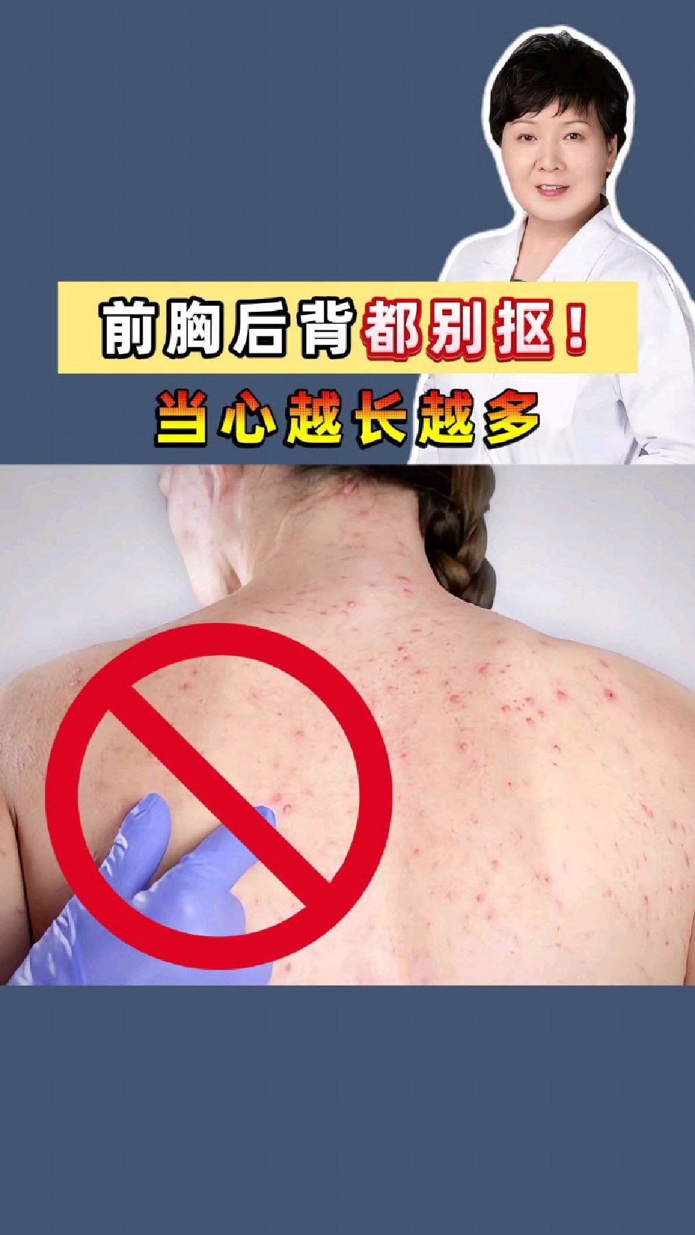 前胸后背长痘怎么回事