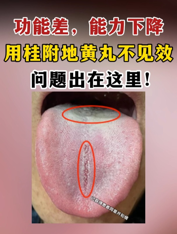 功能差,那方面能力下降,用桂附地黄丸不见效,问题出在这里!