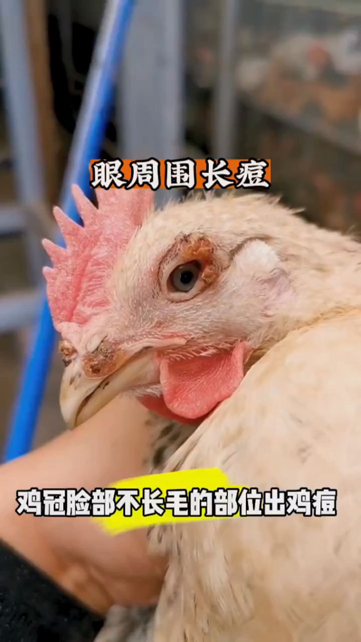 鸡眼周围长了很多痘痘。