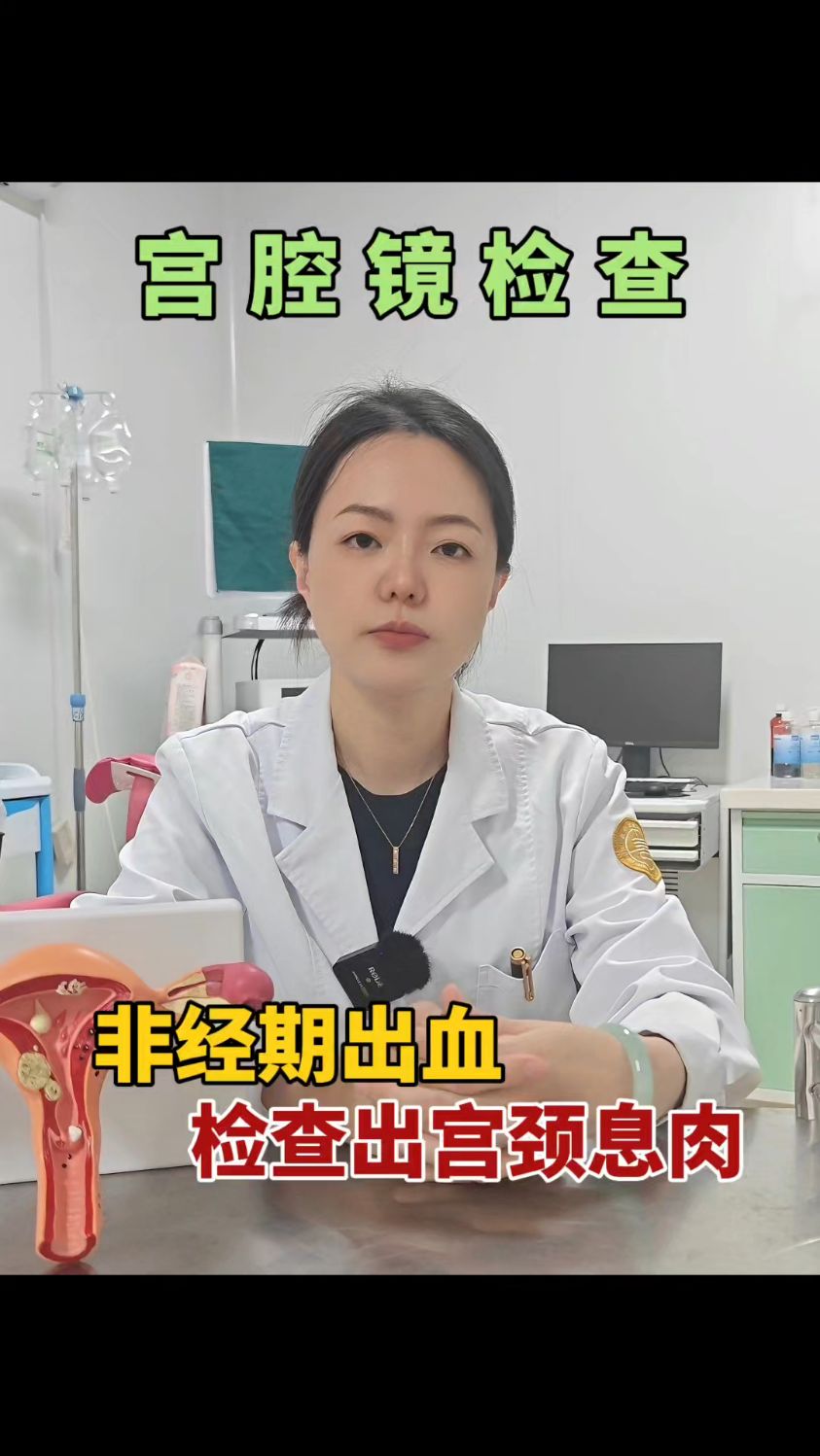 宫腔镜检查 宫颈息肉