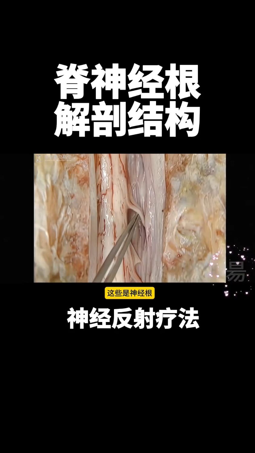 脊神经根的解剖结构