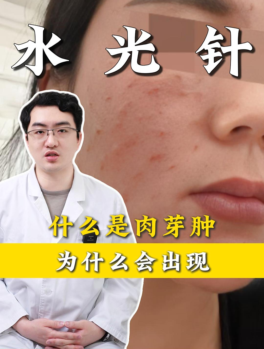 什么是肉芽肿,为什么会出现