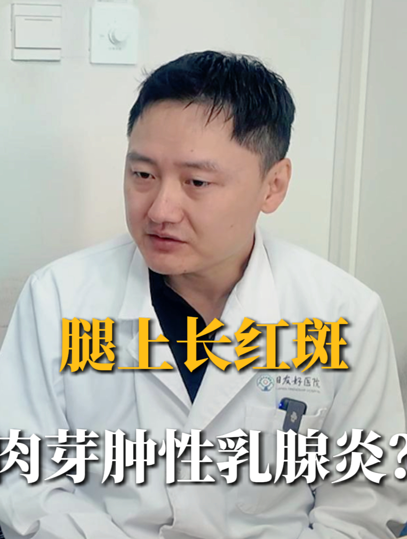 身上长红斑,结合一系列病情,诊断明确,就是肉芽肿性乳腺炎