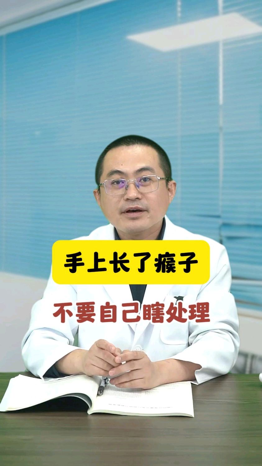 手上长了瘊子,不要自己瞎处理,小心越长越多