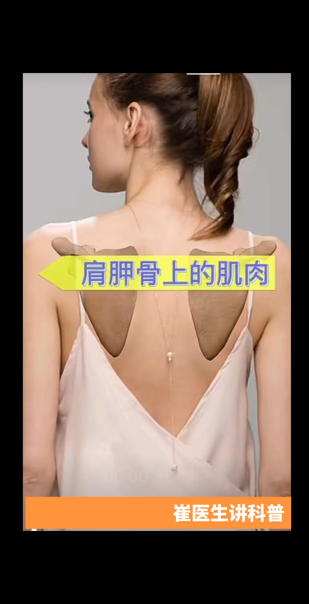 3D医学动画|肩胛骨上的肌肉