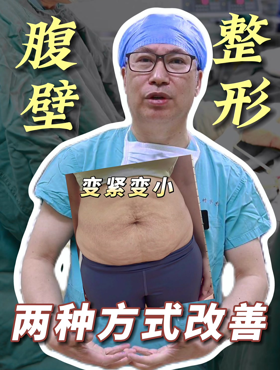 小肚子下垂,皮肤松弛,腹直肌分离,哪些情况适合做腹壁整形?