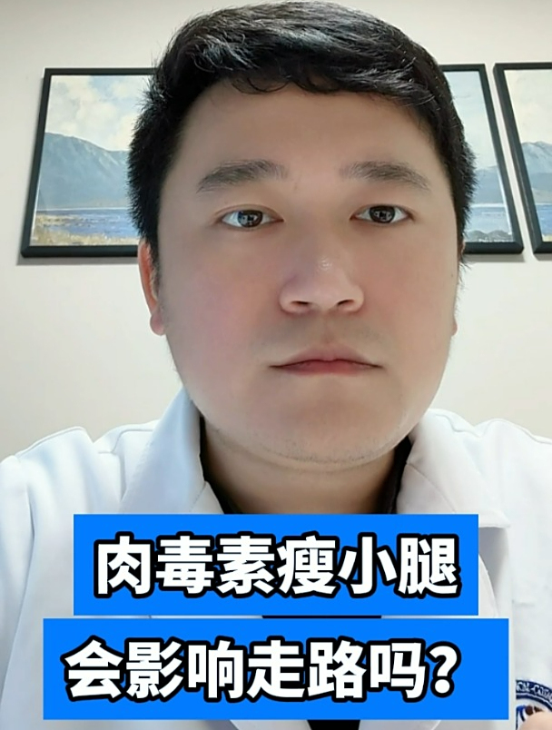 肉毒素瘦小腿会影响走路吗?