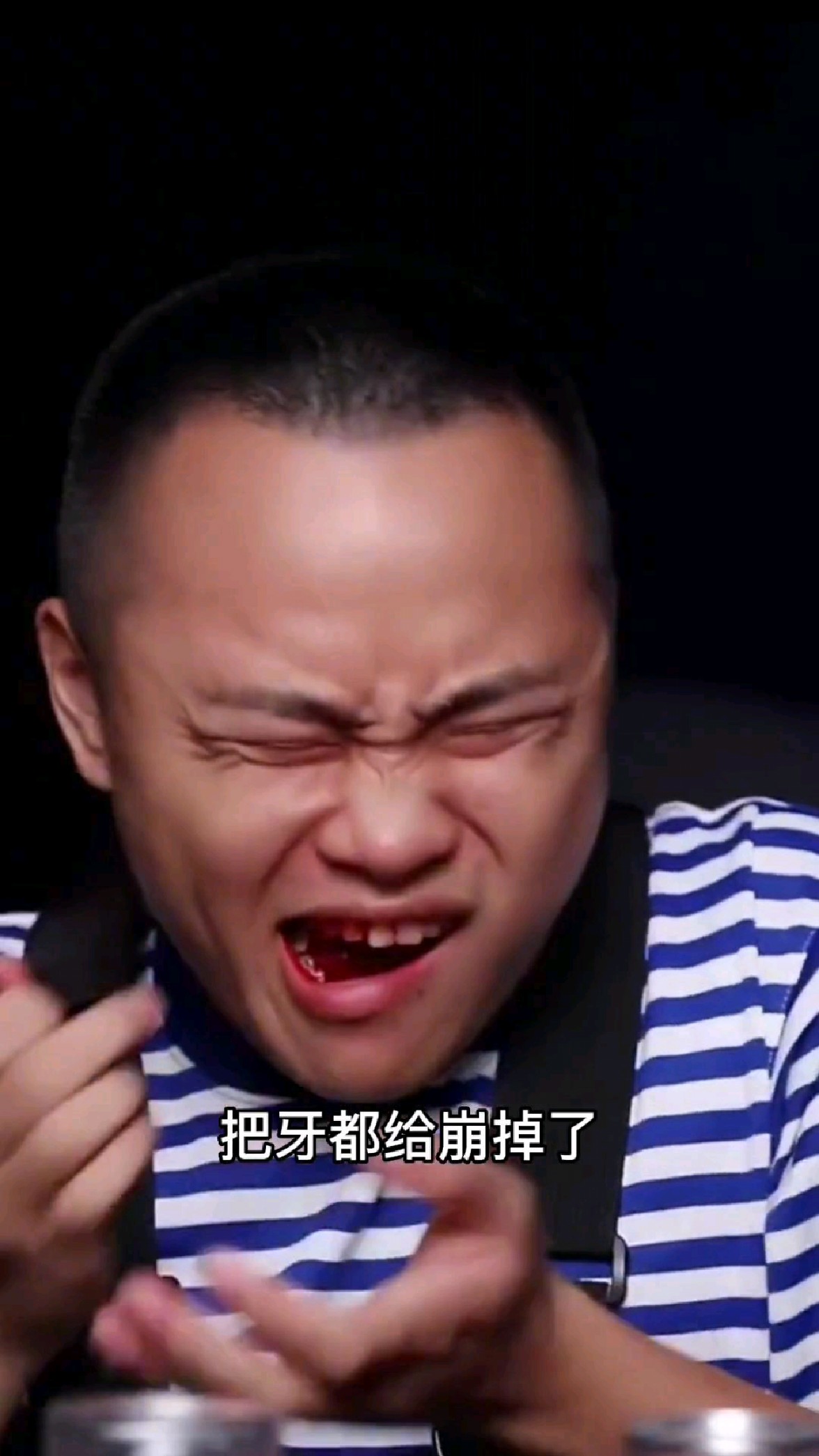 吃鸡肉条把牙齿蹦掉了?