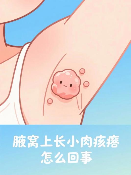 腋窝上长小肉疙瘩怎么回事 #健康扬帆季#