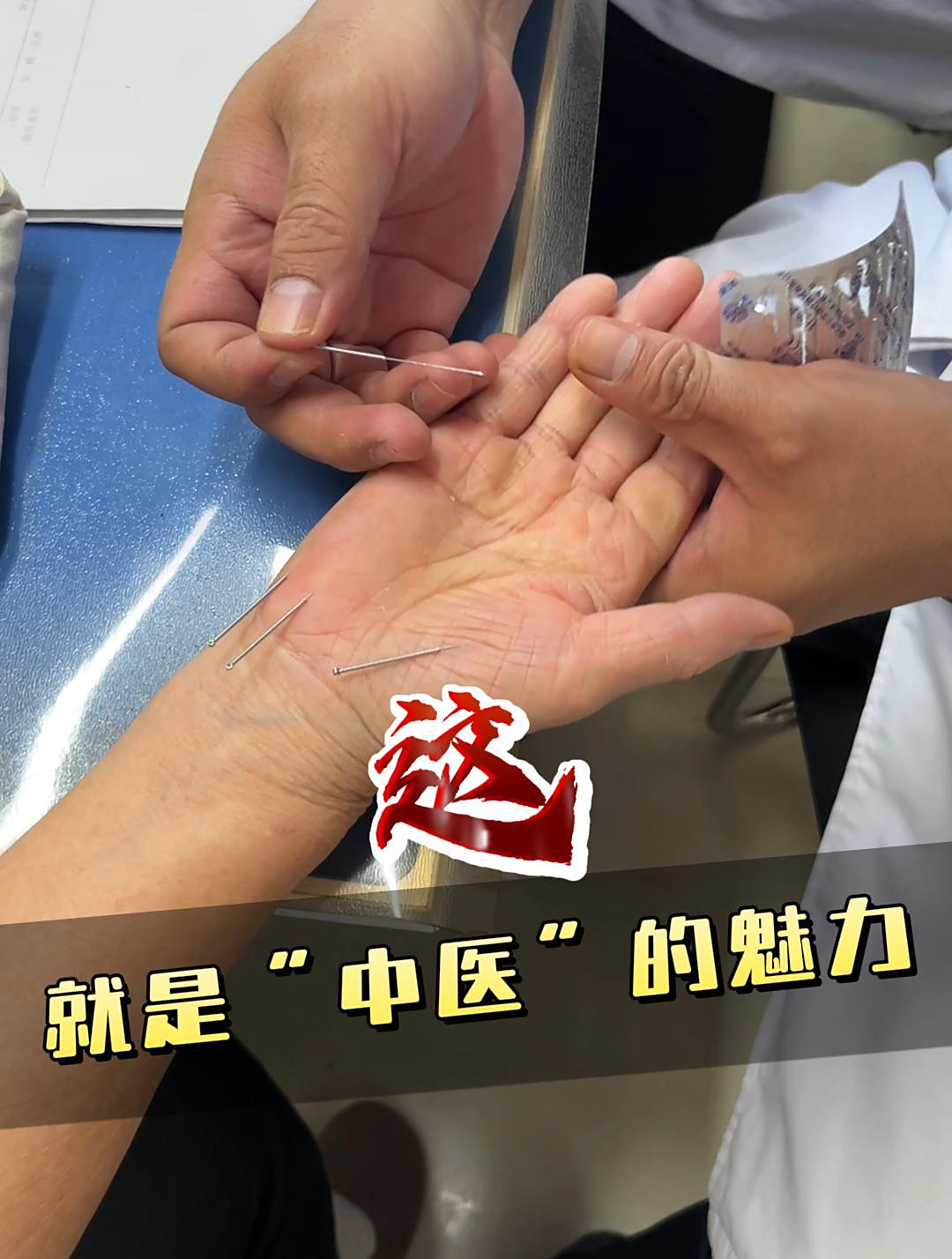 “这就是中医的魅力”