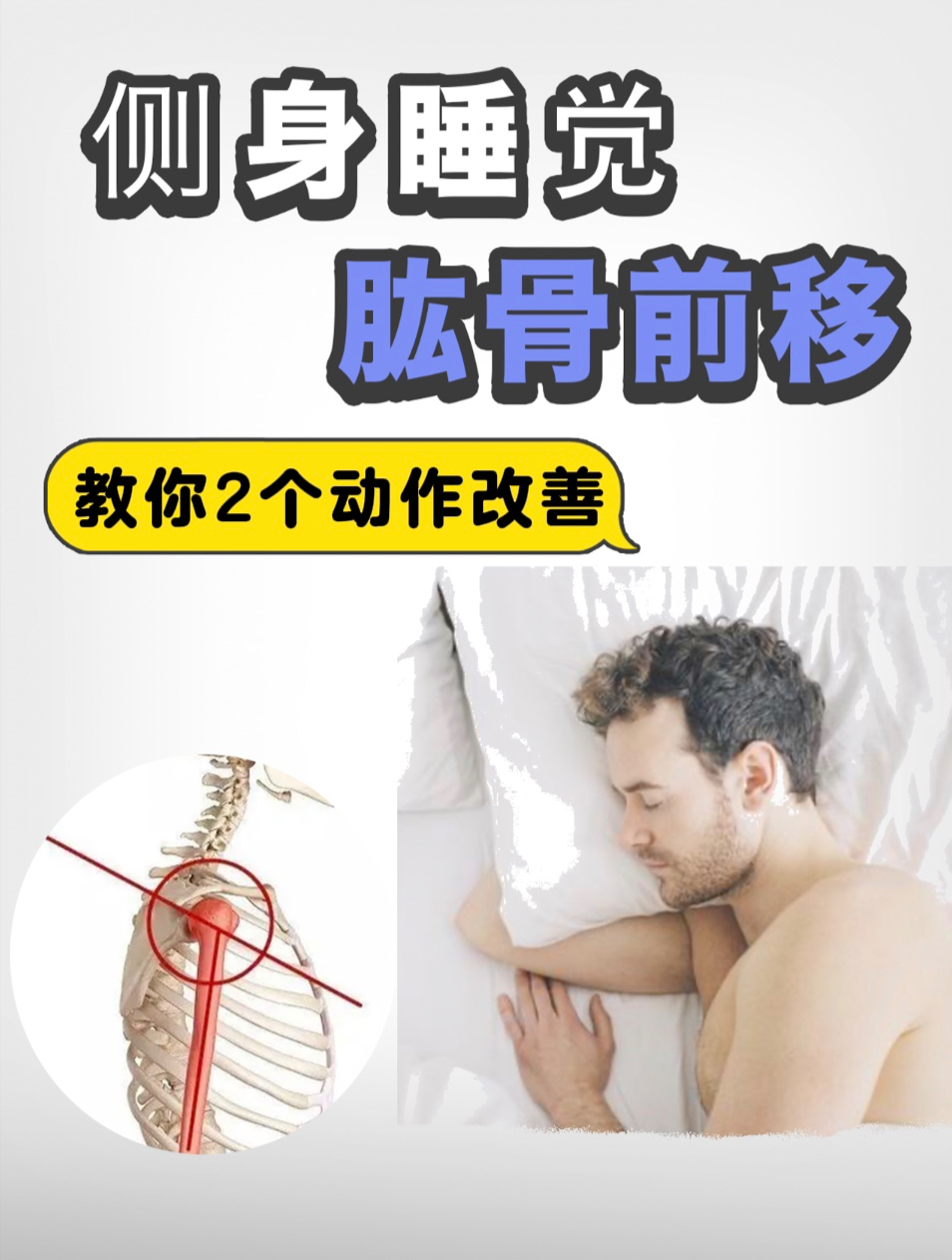 侧身睡觉肱骨前移,教你2个动作改善