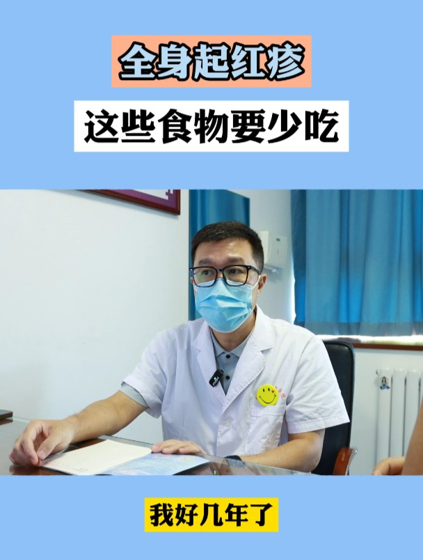 全身起红疹,这些食物要少吃