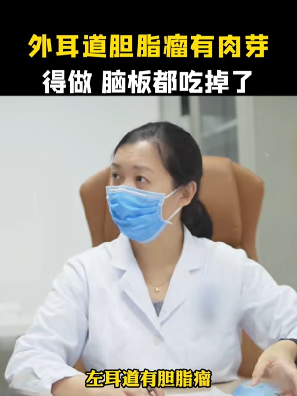 外耳道胆脂瘤有肉芽 得做脑板都吃掉了