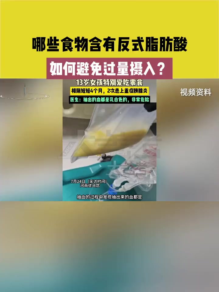 哪些食物含有反式脂肪酸 如何避免过量摄入?常识中国(新闻连连看)