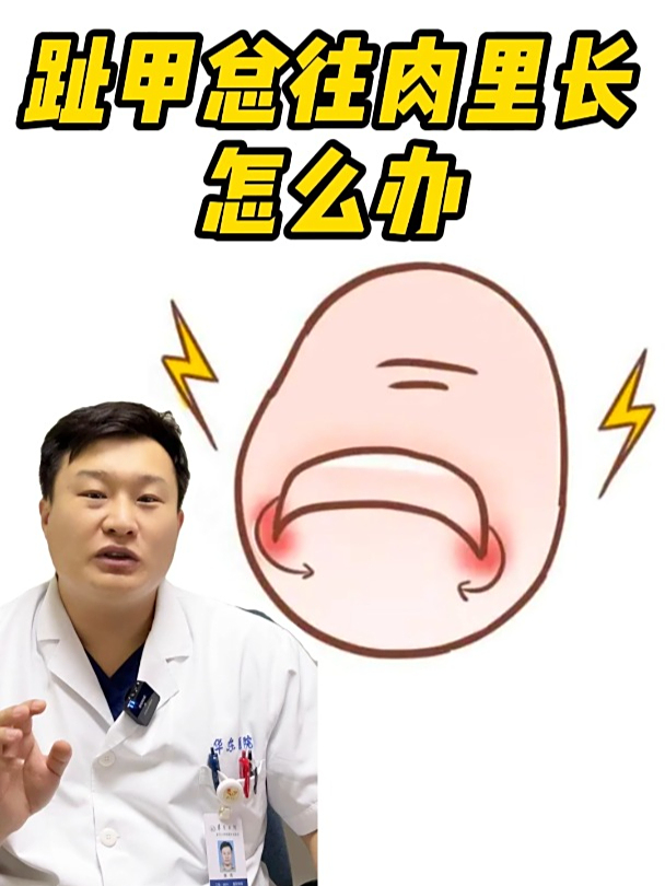 趾甲总往肉里长怎么办