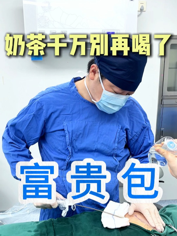 奶茶饮料千万别再喝了!小心富贵包