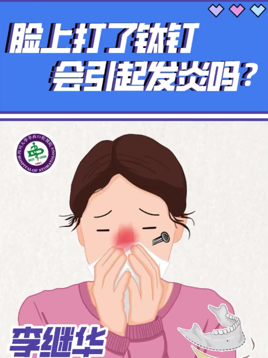 脸上打了钛钉会引起发炎吗?