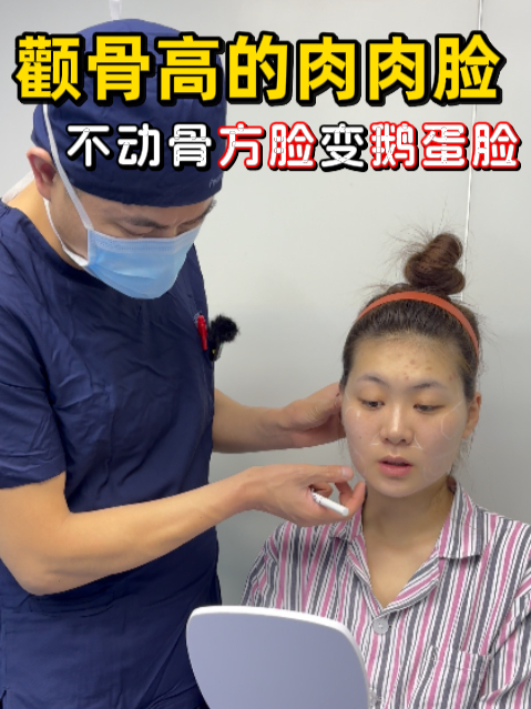 颧骨高下颌宽的阔面脸,不动骨逆袭精致鹅蛋脸了!