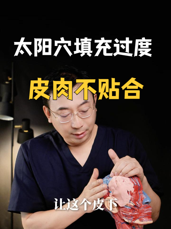 一个视频看懂如何修复太阳穴填充过度导致皮肉不贴合问题