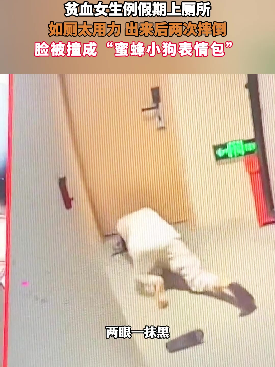 贫血女生例假期上厕所,如厕太用力 出来后两次摔倒,脸被撞成“蜜蜂小狗表情包”