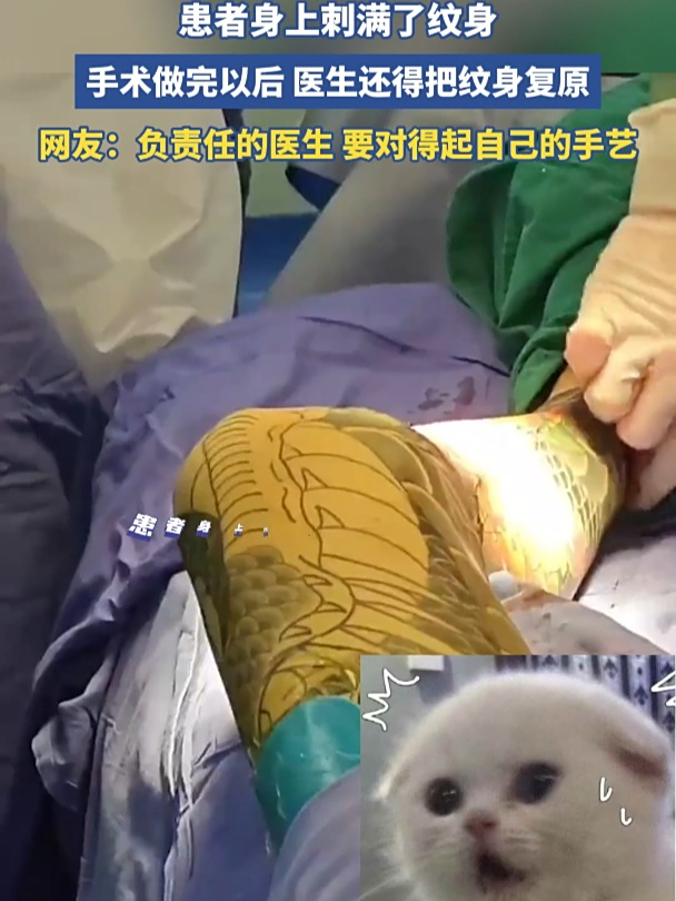 患者身上刺满了纹身,手术做完以后医生还得把纹身复原