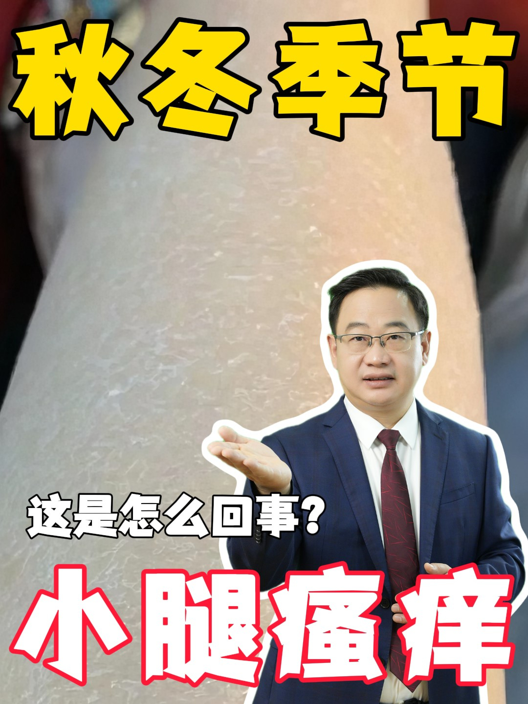 秋冬小腿痒,这是怎么回事?